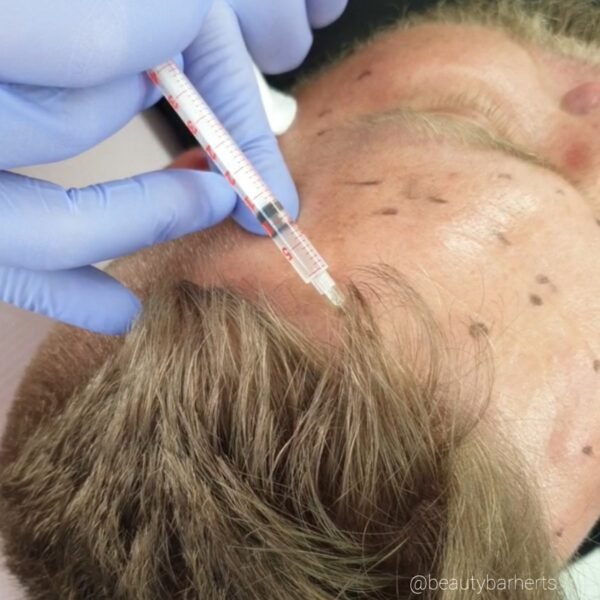 botox for men hertfordshire