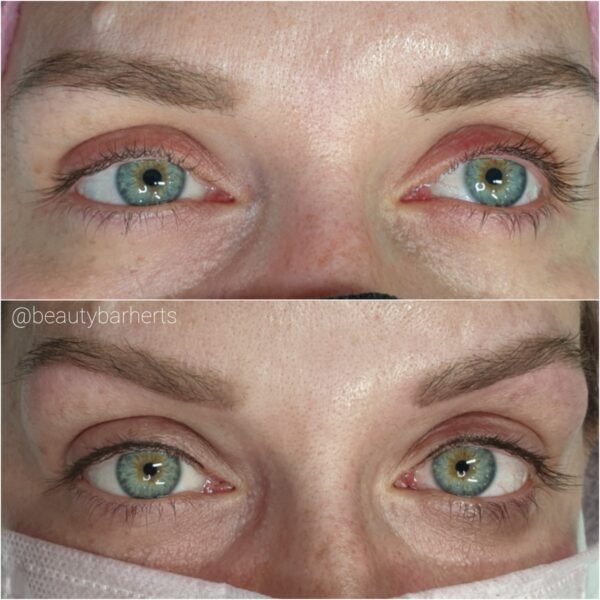 eyeliner permanent before after