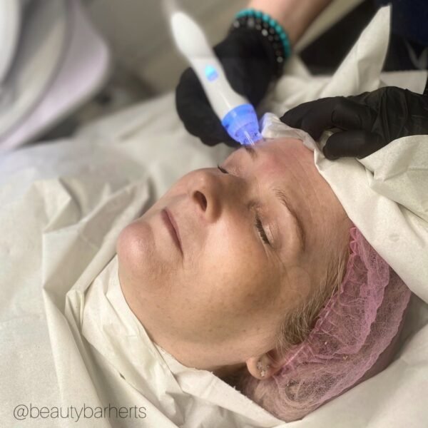 hydrofacial hertfordshire