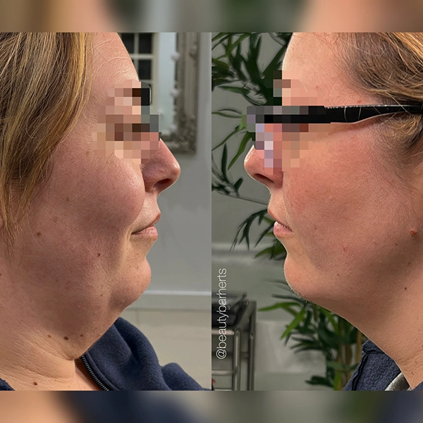 weight loss treatments sawbridgeworth