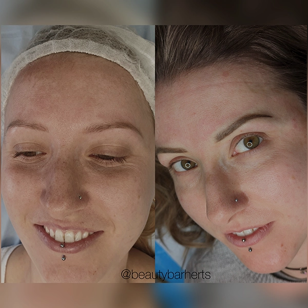 best permanent brows hertford