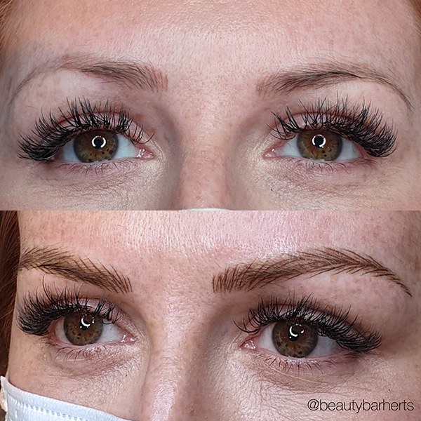 nano stroke brows hertfordshire