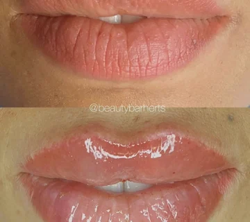 semi permanent lip tattoo and lip filler hertfordshire