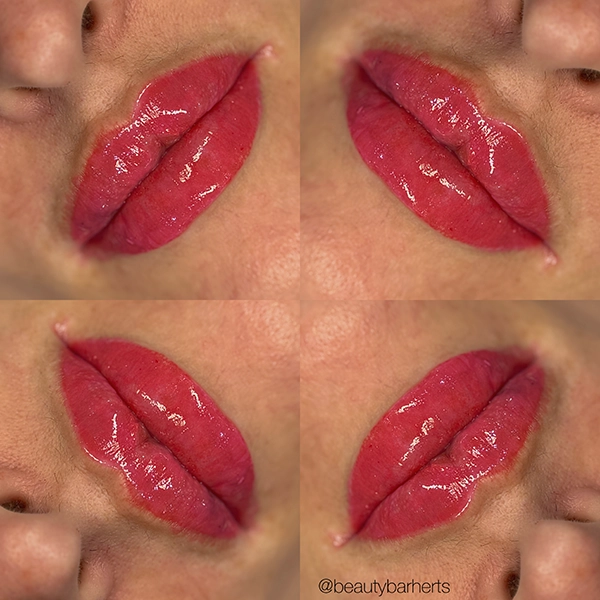 semi permanent lip tattoo with lip filler stevenage