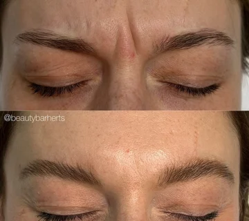 wrinkle prevent tips ware
