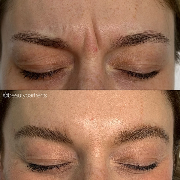 wrinkle prevent tips ware