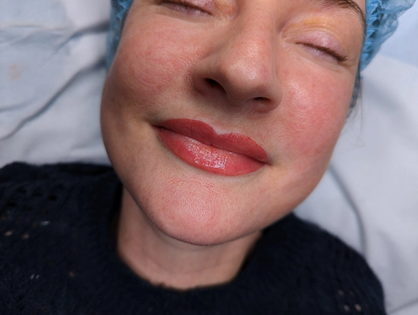 do semi permanent lips hurt buntingford