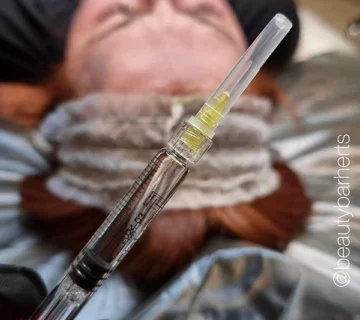 mesotherapy vs skin boosters hertfordshire