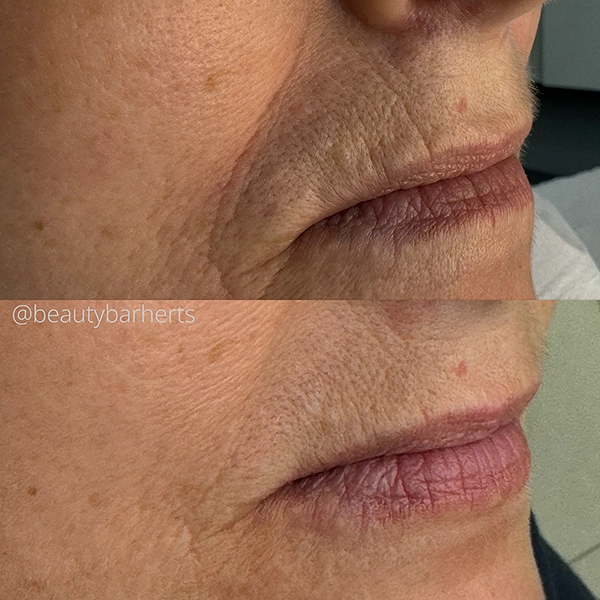 how to prevent skin ageing ware how to prevent skin ageing ware