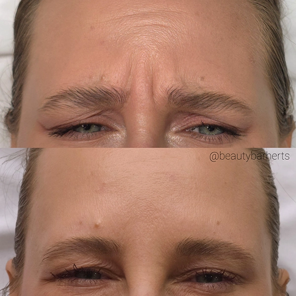 skin ageing prevention hertfordshire skin ageing prevention hertfordshire