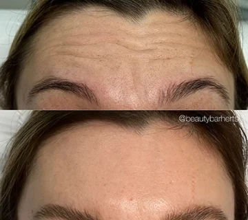 How to look years younger ware beauty bar