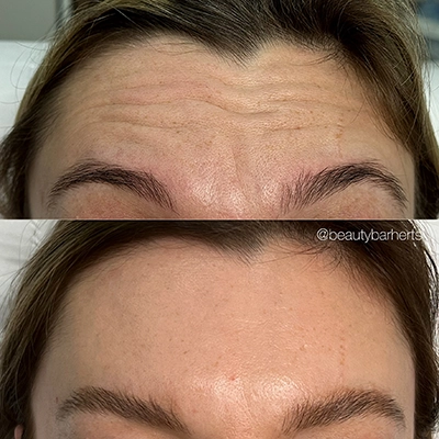 How to look years younger ware beauty bar