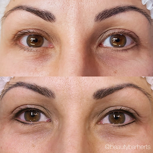 Hooded eyes permanent eyeliner ware