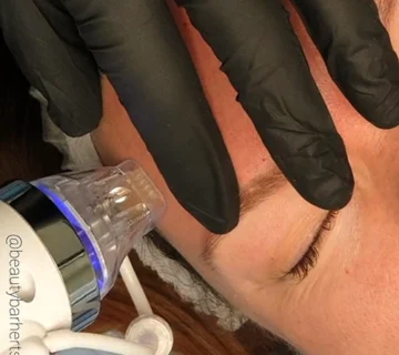 Rf microneedling and microneedling compare beauty bar