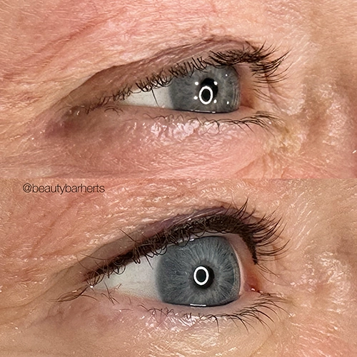 hooded eyelids permanent eyeliner hoddesdon Hooded eyelids permanent eyeliner hoddesdon