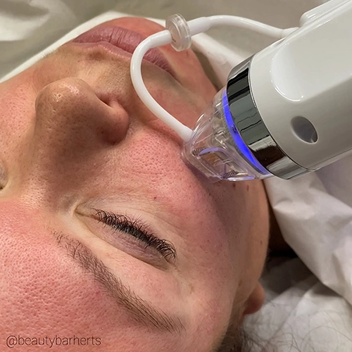 non surgical facelift welwyn garden city Non surgical facelift welwyn garden city